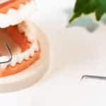 periodontitis bilbao