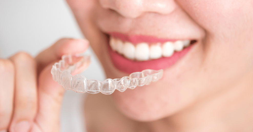 Cómo saber si puedo usar Invisalign