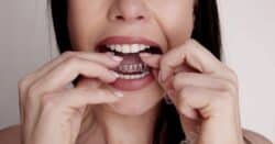 tratamiento invisalign barakaldo