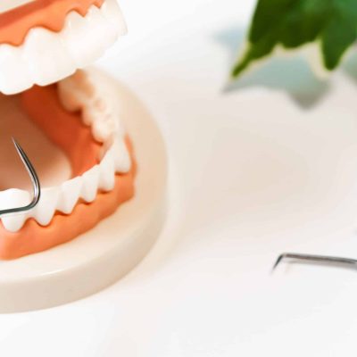 periodontitis bilbao